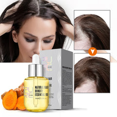 Hair and Scalp Treatment Oil for Hair Growth and Loss Prevention - Suitable for Men and Women