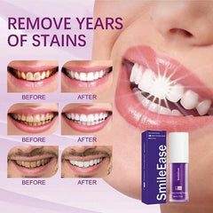 V34 Purple Whitening Toothpaste Removal Tooth Stains Repairing Caring Teeth Orthodontic Toothpaste Fresh Breath Tooth Care New