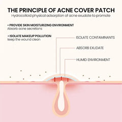 200Pcs Repair Acne Patch Facial Skin Care Fade Blemishes Pimple Marks Closed Acne Blemishes Cover Acne Pimple Repair Patch