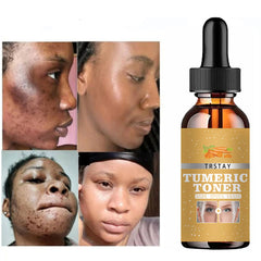 Turmeric Oil Deep Moisture Serums Brighten Fade Dark Spot Removal Pigment Melanin Correcting Beauty Face Skin Care