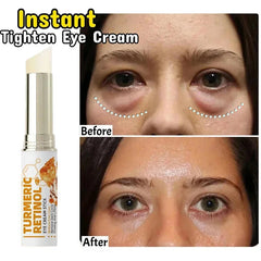 Instant Eye Bag Remove Eye Cream anti Fat Particles Dark Circles Puffiness Fade Fine Lines Lift Brighten Korean Beauty Eye Care