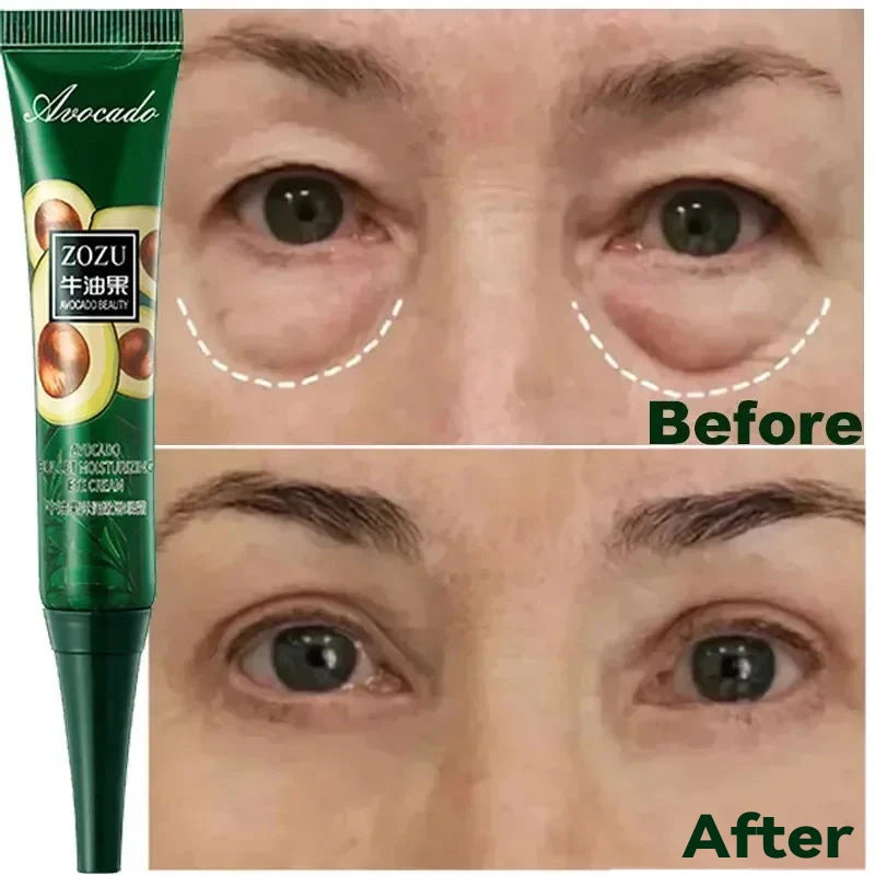 7 Day Tighten Wrinkles Eye Cream anti Dark Circles Bags Puffiness Fade Eye Fine Line Whiten under Eyes Skin Korean Care