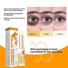 Instant Eye Bag Remove Eye Cream anti Fat Particles Dark Circles Puffiness Fade Fine Lines Lift Brighten Korean Beauty Eye Care