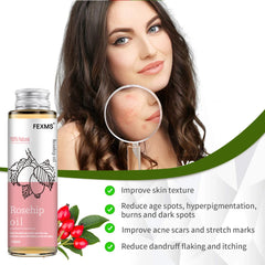 Rosehip Seed Oil, 100% Pure Organic Unrefined Cold Pressed anti Aging Rose Hip Moisturizer for Hair Skin & Nails