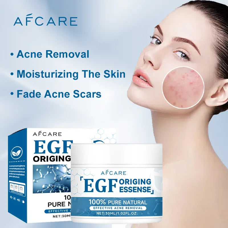 Afcare EGF Face Acne Treatment Cream Lightening Acne Remover Pimple Repair Skin Whitening Moisturizing Beauty Health Skincare