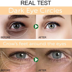 Instant Eye Bag Remove Eye Cream anti Fat Particles Dark Circles Puffiness Fade Fine Lines Lift Brighten Korean Beauty Eye Care