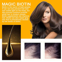 5PCS Biotin Repair Damaged Hair Care Essential Oils Enhance Hair Roots Spray Scalp Treatment for Men Women