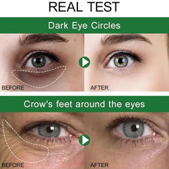 7 Day Tighten Wrinkles Eye Cream anti Dark Circles Bags Puffiness Fade Eye Fine Line Whiten under Eyes Skin Korean Care