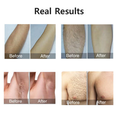 Advanced IPL Hair Removal Laser Epilator 999999 Flashes Permanent Painless Solution for Smooth Skin on Body Face