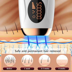 Advanced IPL Hair Removal Laser Epilator 999999 Flashes Permanent Painless Solution for Smooth Skin on Body Face