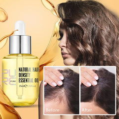 Hair and Scalp Treatment Oil for Hair Growth and Loss Prevention - Suitable for Men and Women