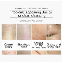 Nicotinamide Amino Acid Face Cleanser Facial Scrub Cleansing Acne Oil Control Blackhead Remover Shrink Pores Skin Care