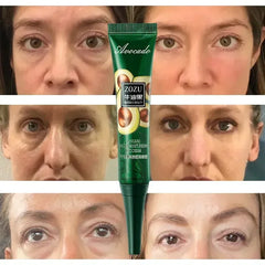 7 Day Tighten Wrinkles Eye Cream anti Dark Circles Bags Puffiness Fade Eye Fine Line Whiten under Eyes Skin Korean Care