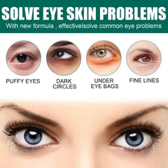 7 Day Tighten Wrinkles Eye Cream anti Dark Circles Bags Puffiness Fade Eye Fine Line Whiten under Eyes Skin Korean Care