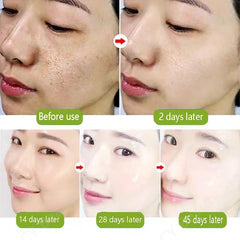 Lactic Acid Pore Shrink Face Serum Remove Blackheads Acne Oil Control Repair Gel Moisturizing Nourish Pores Firming Beauty Care