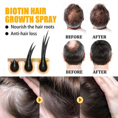 5PCS Biotin Repair Damaged Hair Care Essential Oils Enhance Hair Roots Spray Scalp Treatment for Men Women