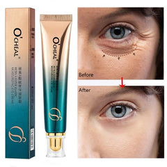 Anti Wrinkle Eye Cream Retinol Fade Fine Lines Anti-Dark Circles Remove Eye Bags Anti-Aging Firming Eye Serum Eye Care Cream