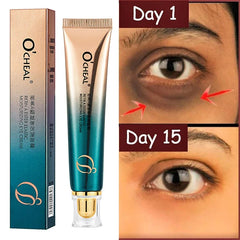 Anti Wrinkle Eye Cream Retinol Fade Fine Lines Anti-Dark Circles Remove Eye Bags Anti-Aging Firming Eye Serum Eye Care Cream