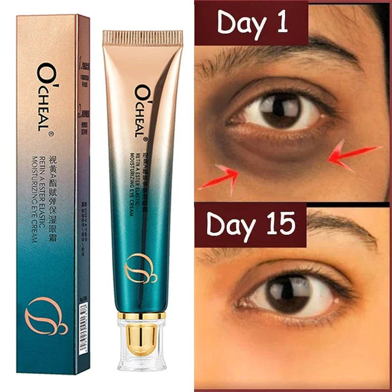 Anti Wrinkle Eye Cream Retinol Fade Fine Lines Anti-Dark Circles Remove Eye Bags Anti-Aging Firming Eye Serum Eye Care Cream