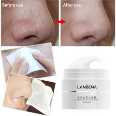 Blackhead Remover Cream Paper Plant Pore Strips Nose Acne Cleansing Black Dots Peel off Mud Mask Treatments Skin Care