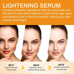 Vitamin C Face Serum with Hyaluronic Acid and Dark Spot Remover - 10ml